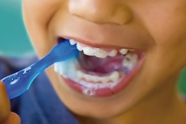Cuatro preguntas sobre la salud bucal infantil