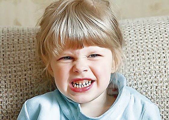 El estrés y la salud bucal de los pequeños