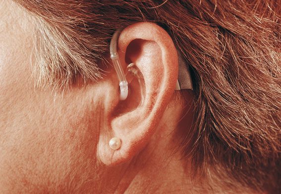 ARG de 67 años: Por qué he perdido audición?